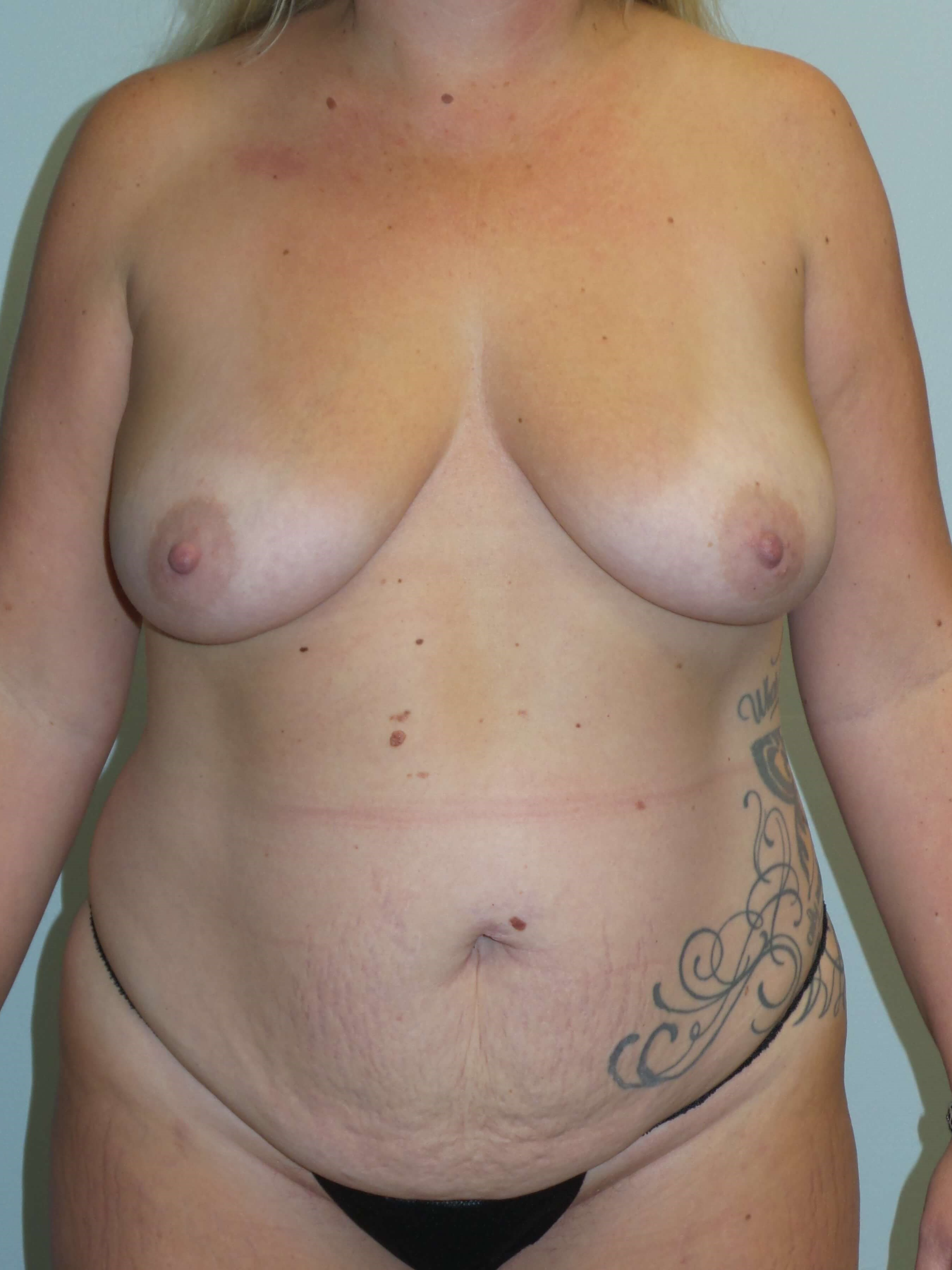 Before Image