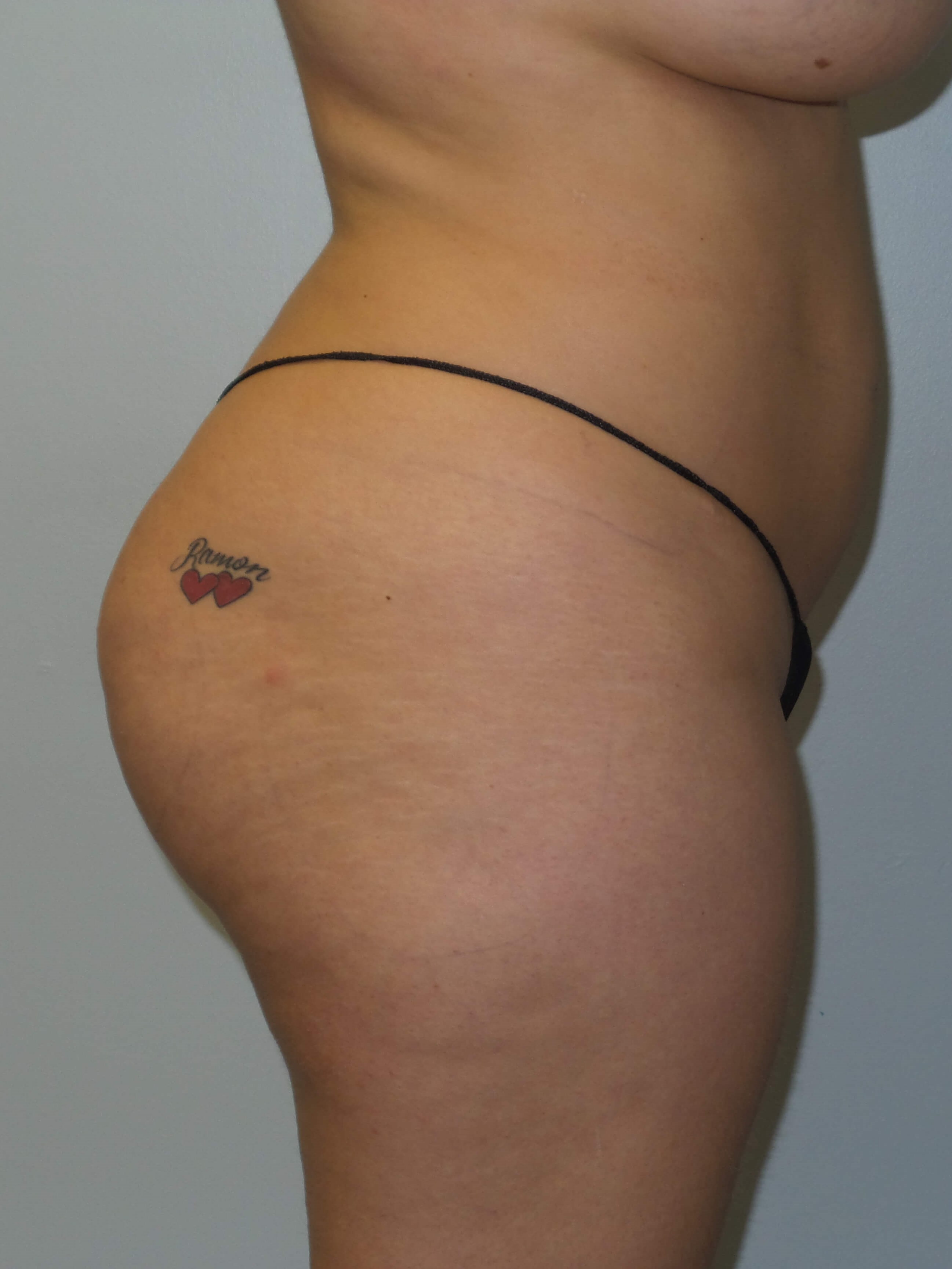 Before Image
