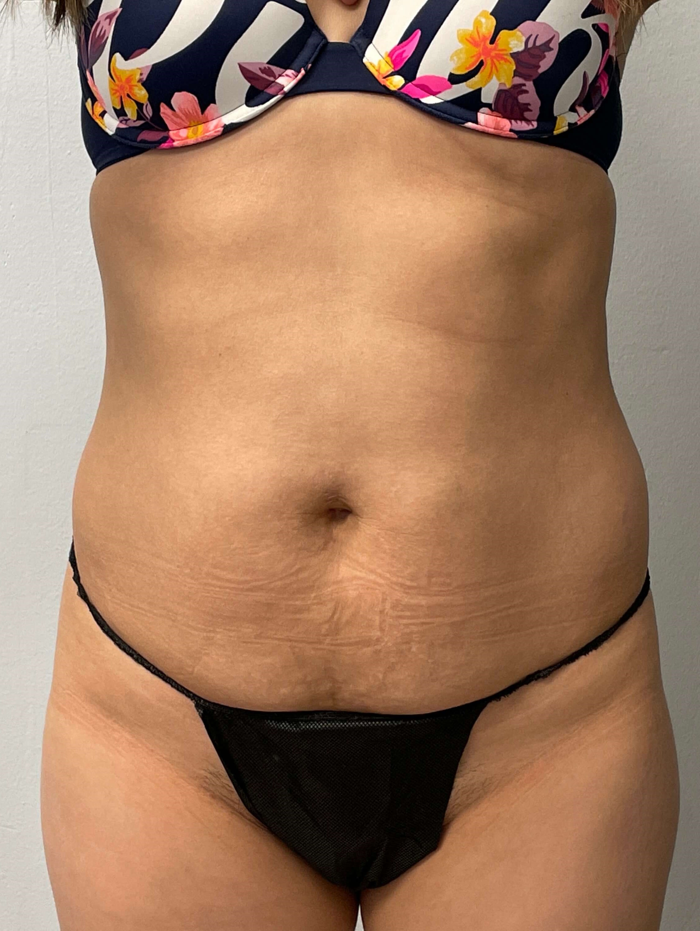 Before Image