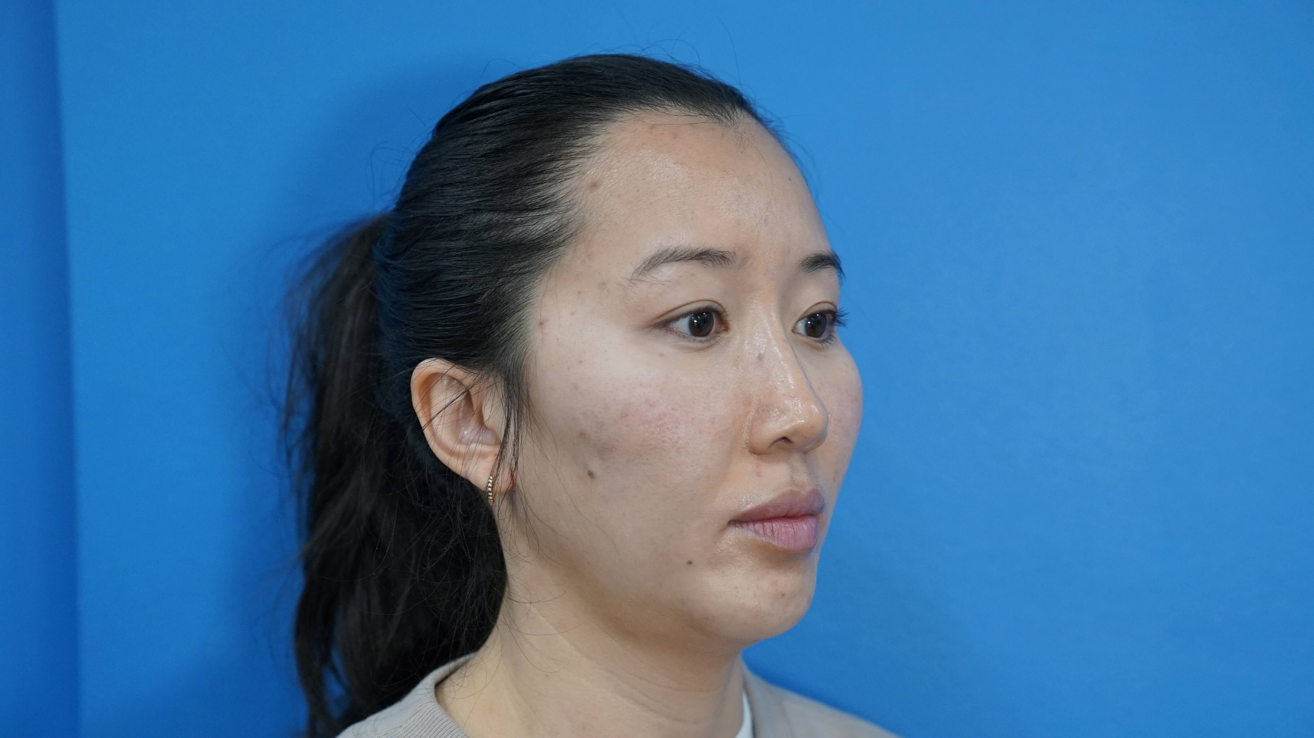Westlake Woman Has Cheek Aug After