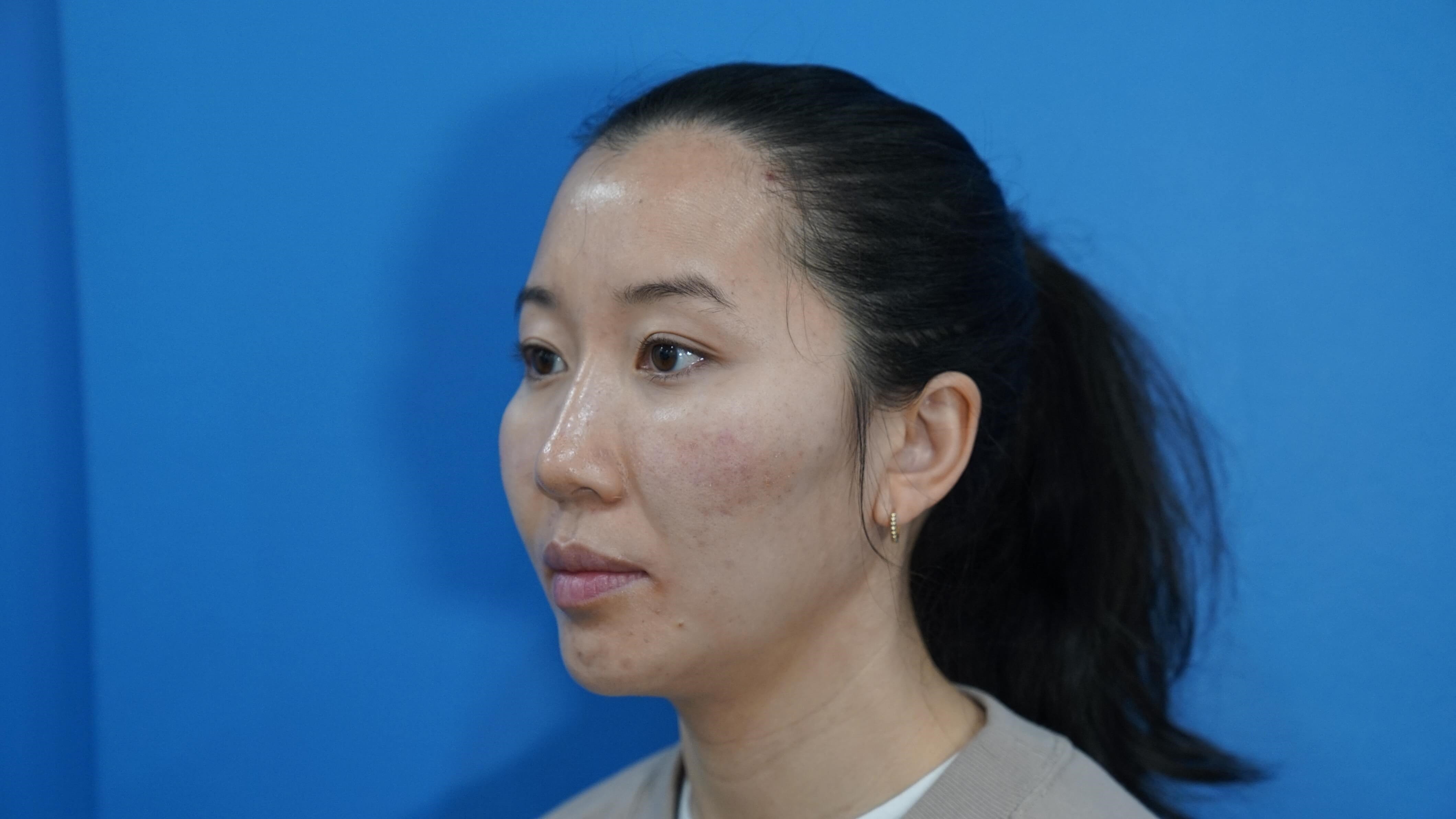Westlake Woman Has Cheek Aug After