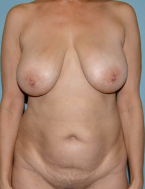 Before Image