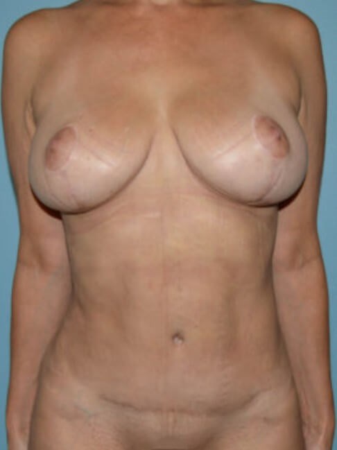 After Image
