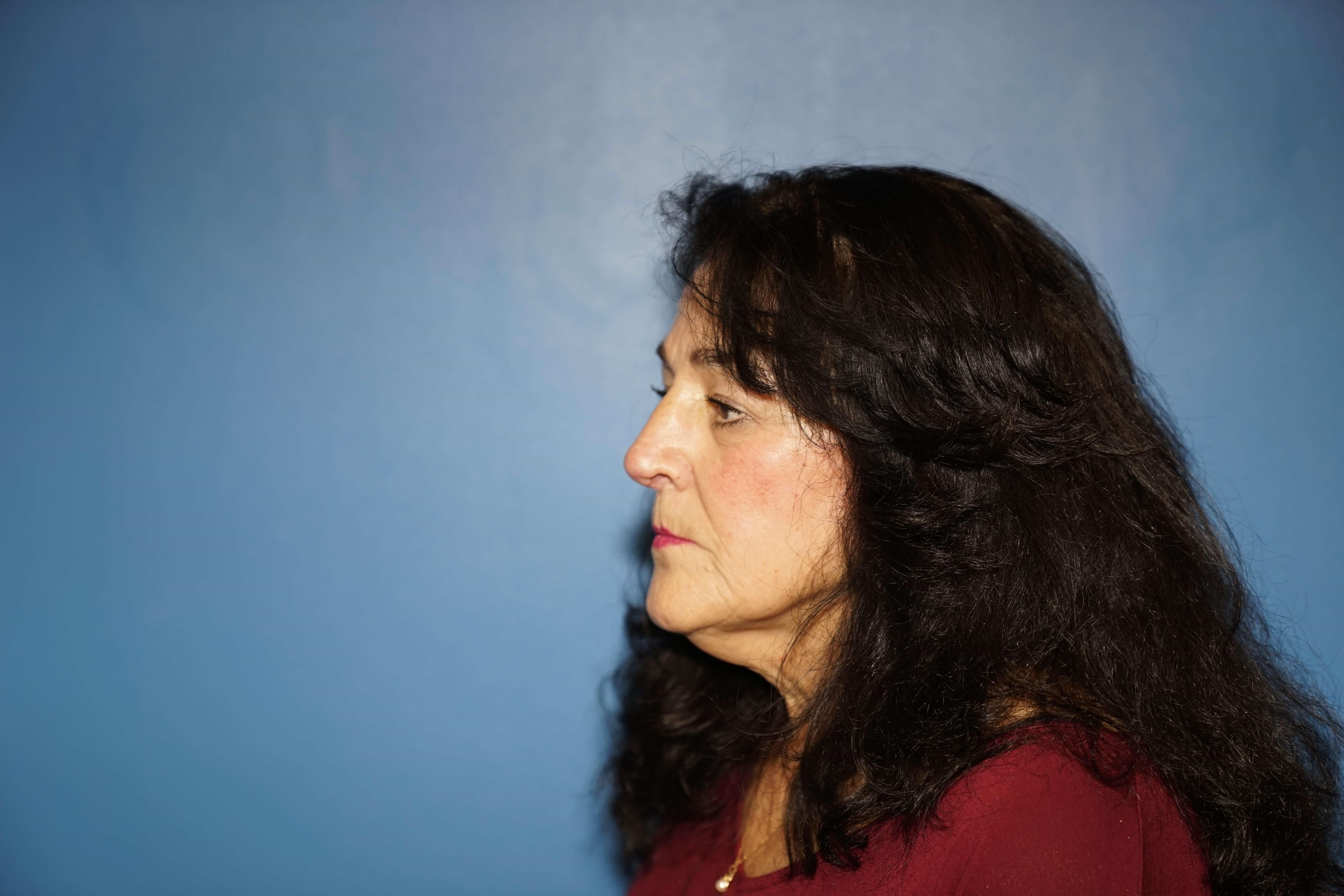 Westlake Woman has Rhinoplasty After