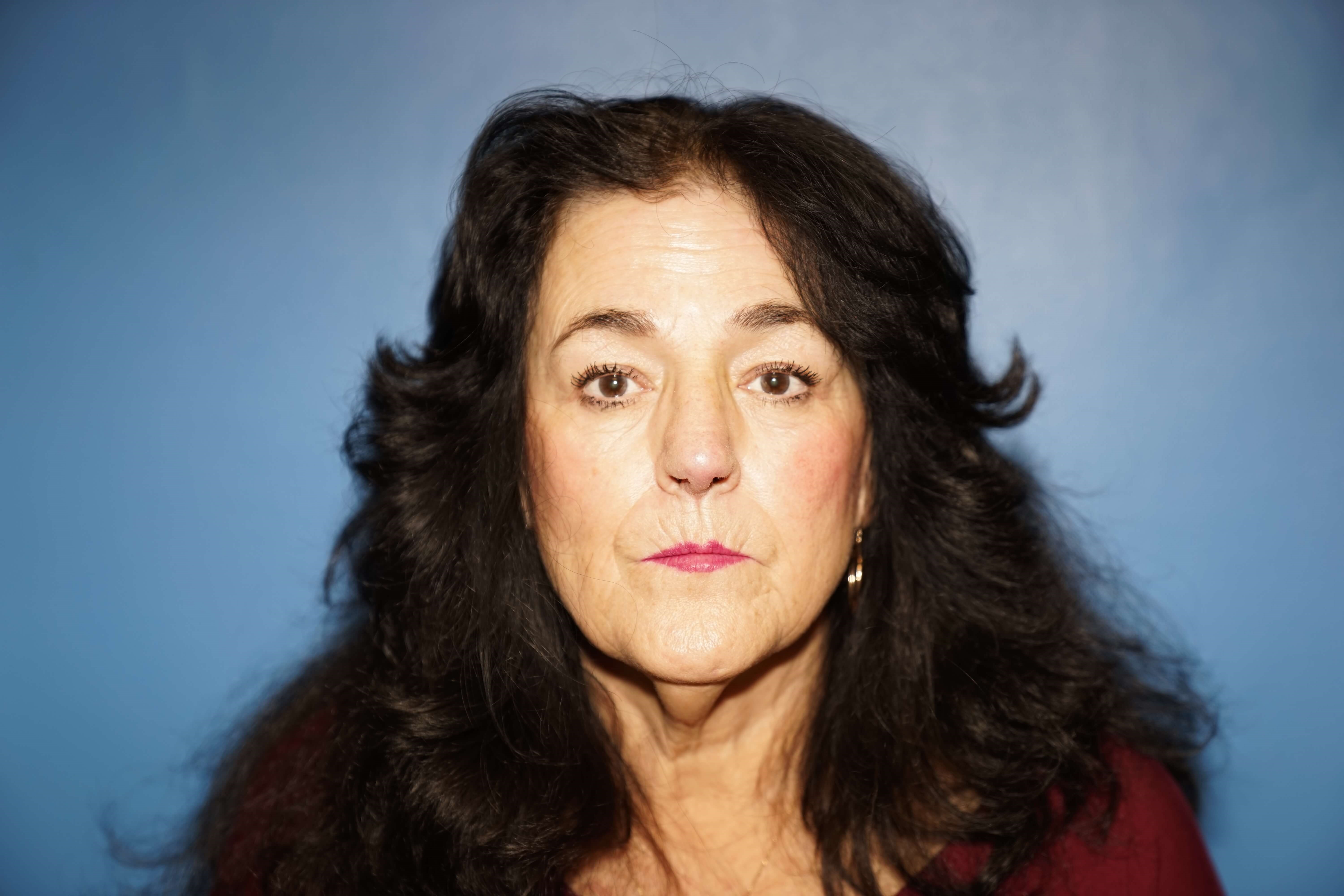 Westlake Woman has Rhinoplasty After
