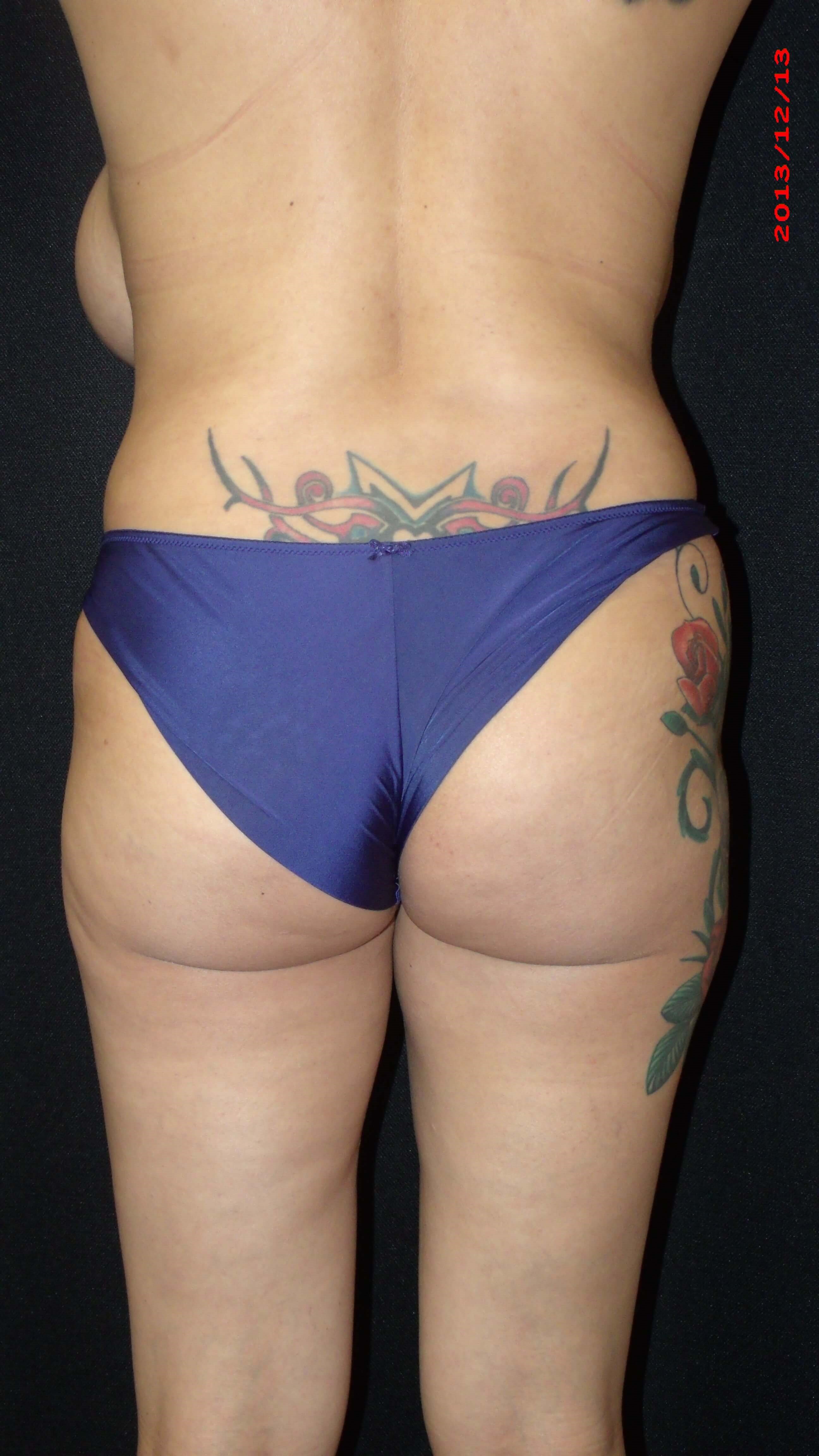 Before Image