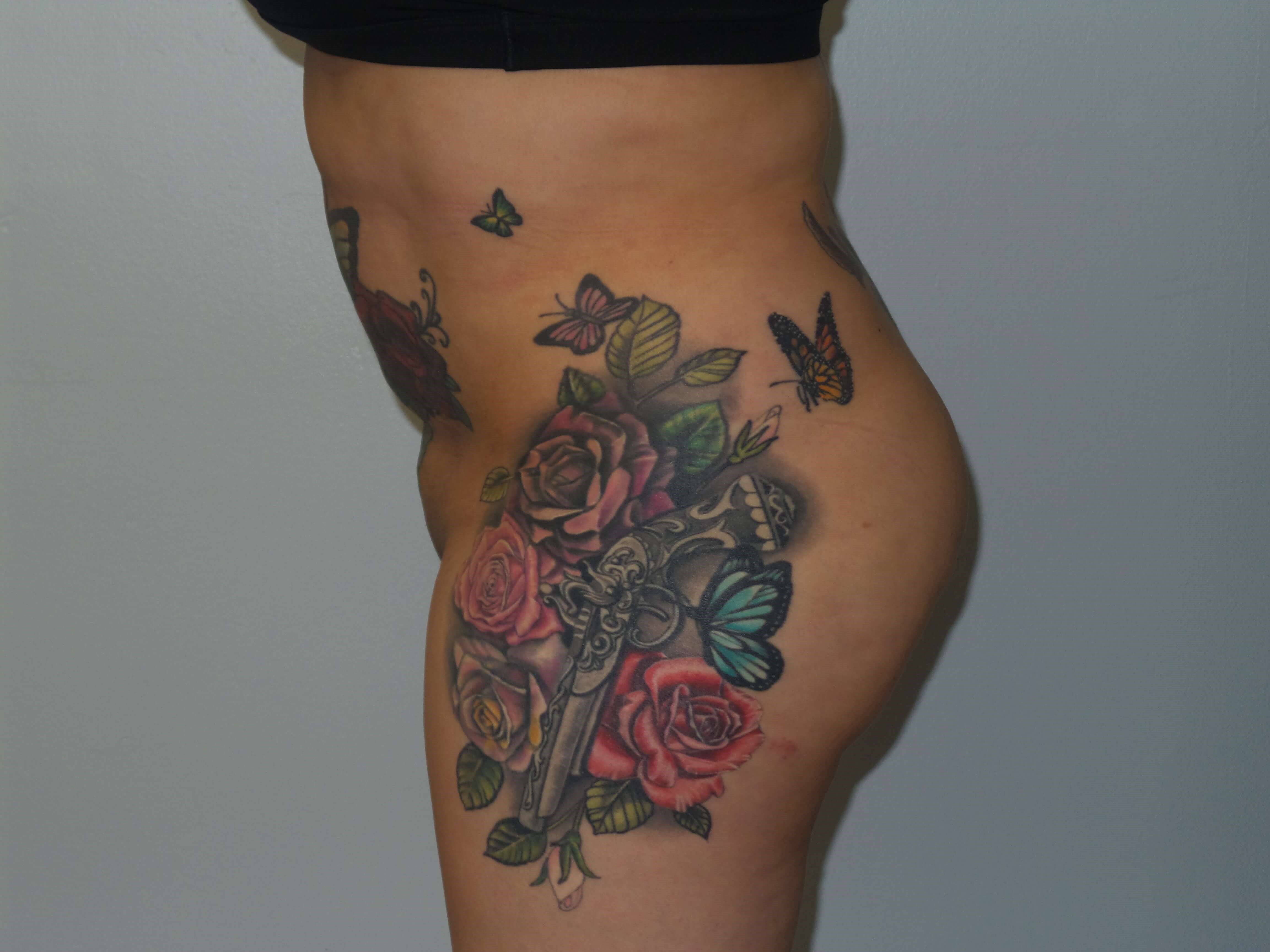Woman has BBL Butt Lift Before