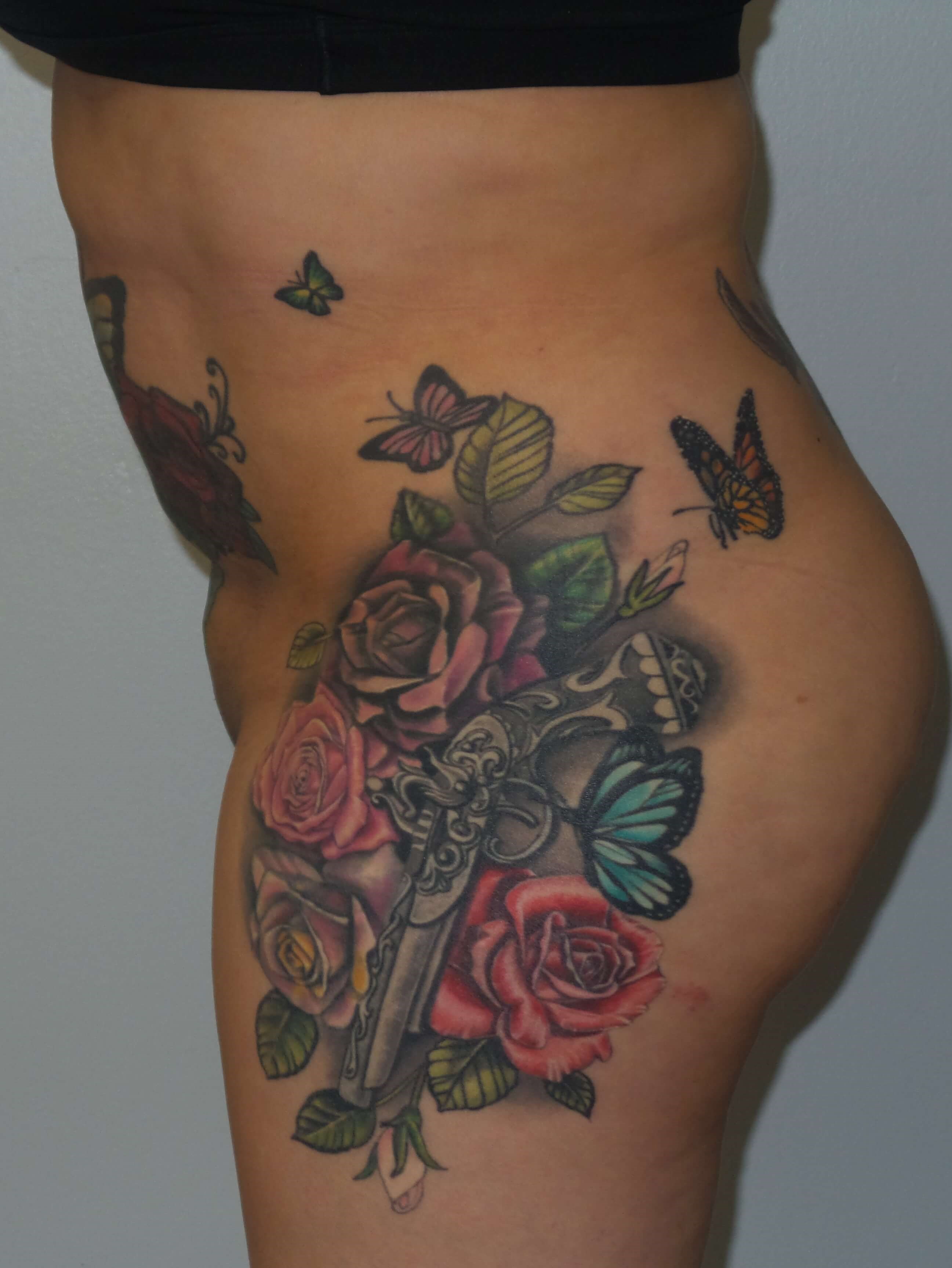 Woman has BBL Butt Lift Before