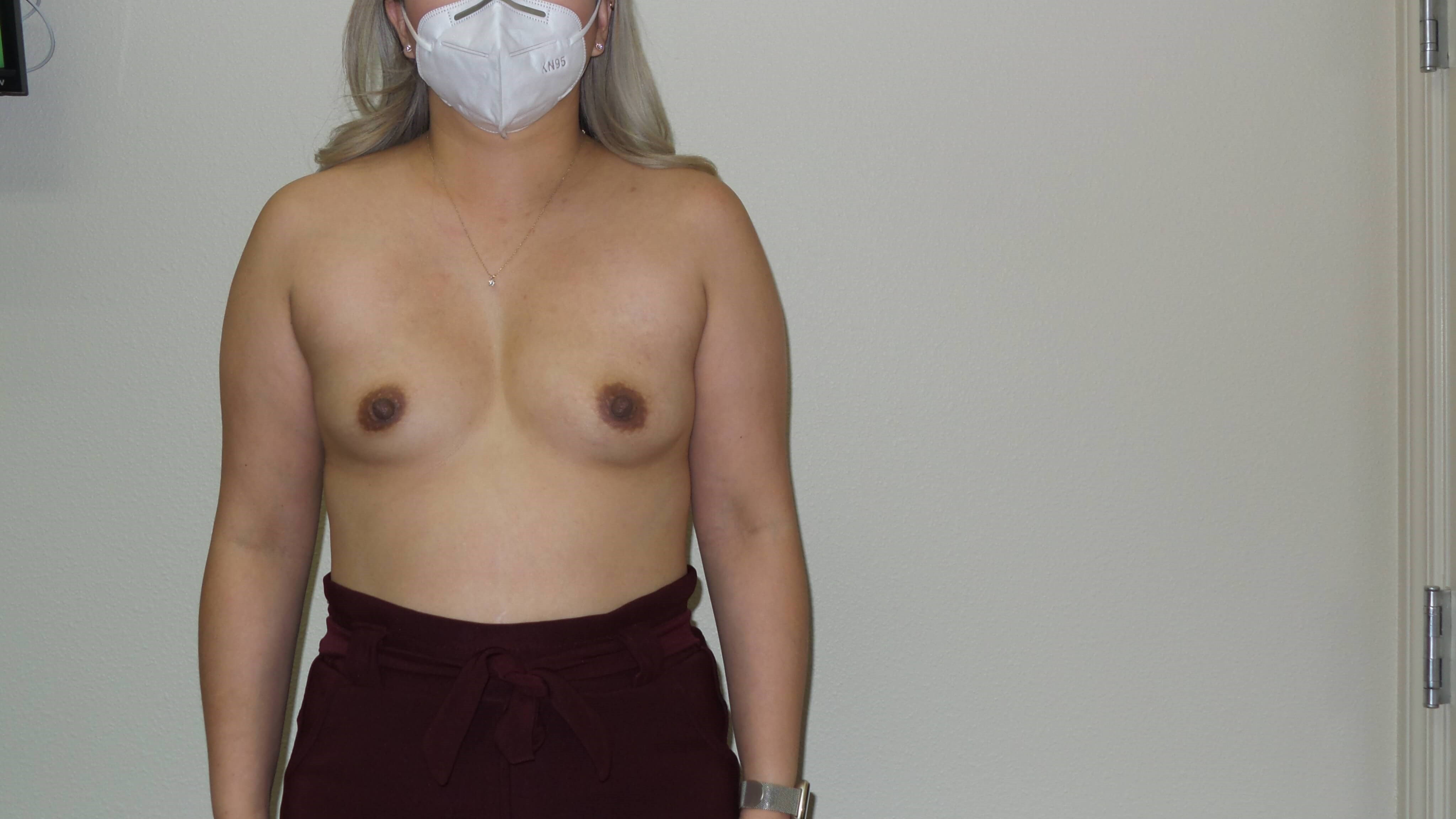Westlake Woman Has Breast Aug Before