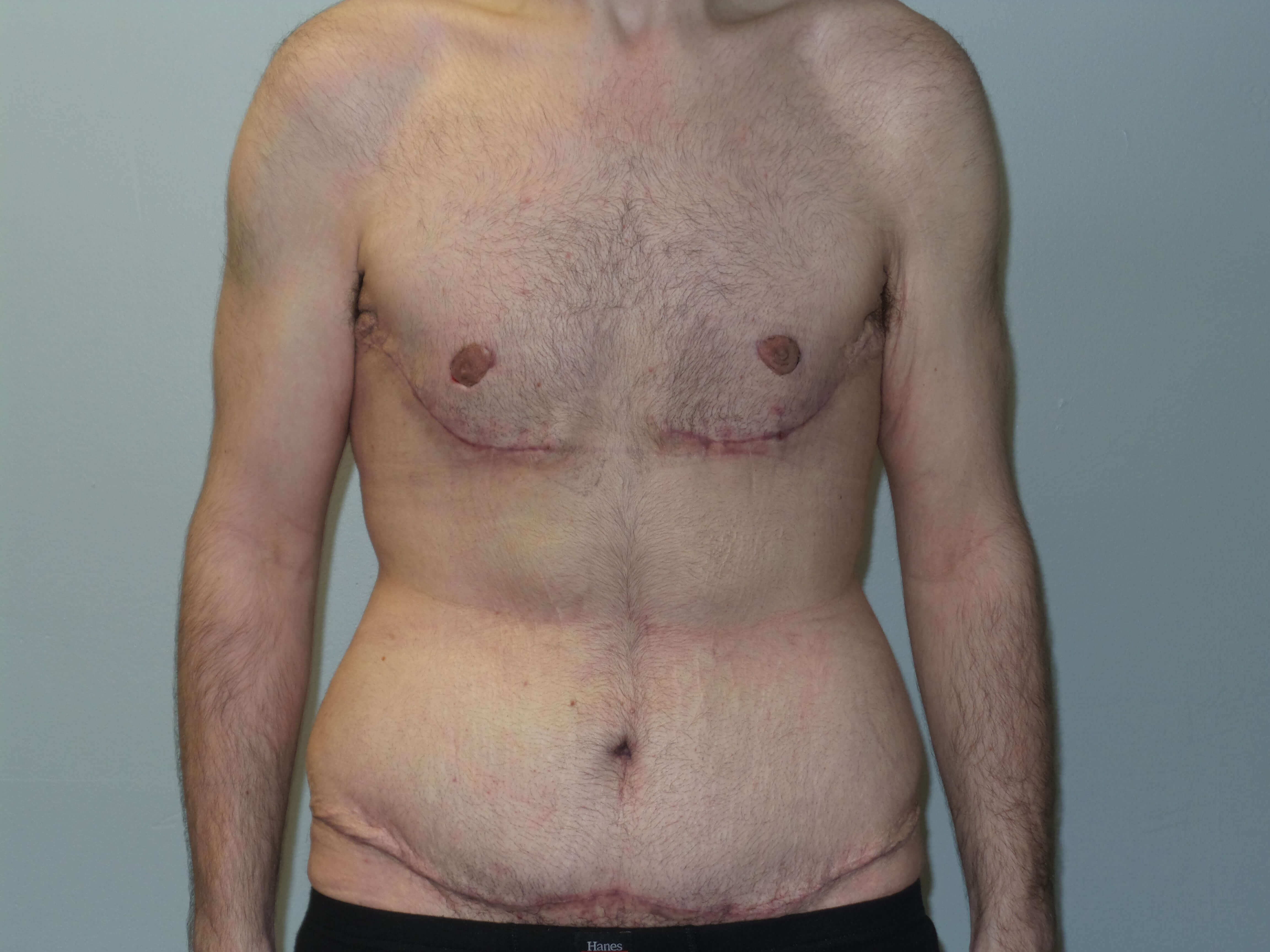 After Image