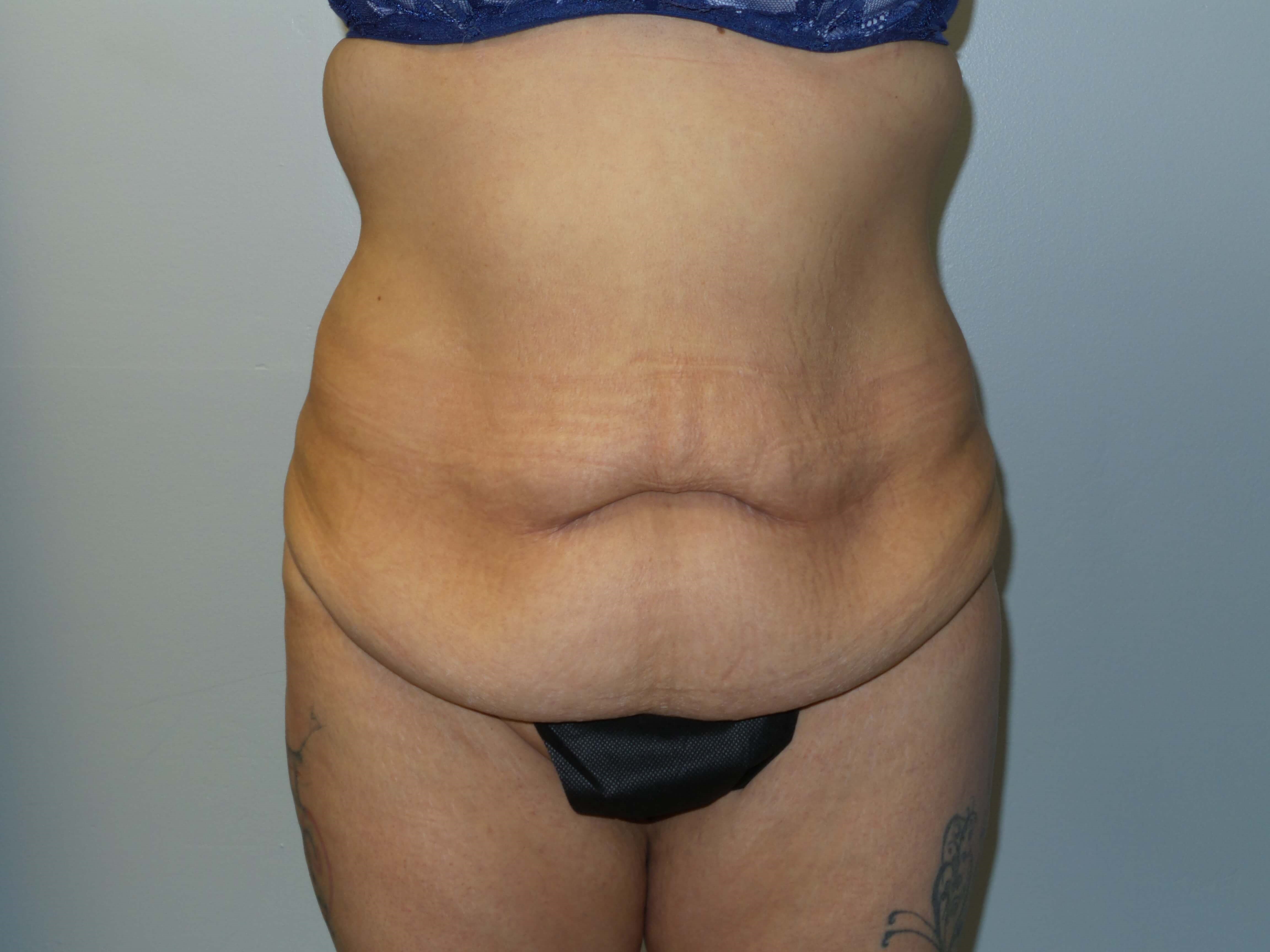 Before Image