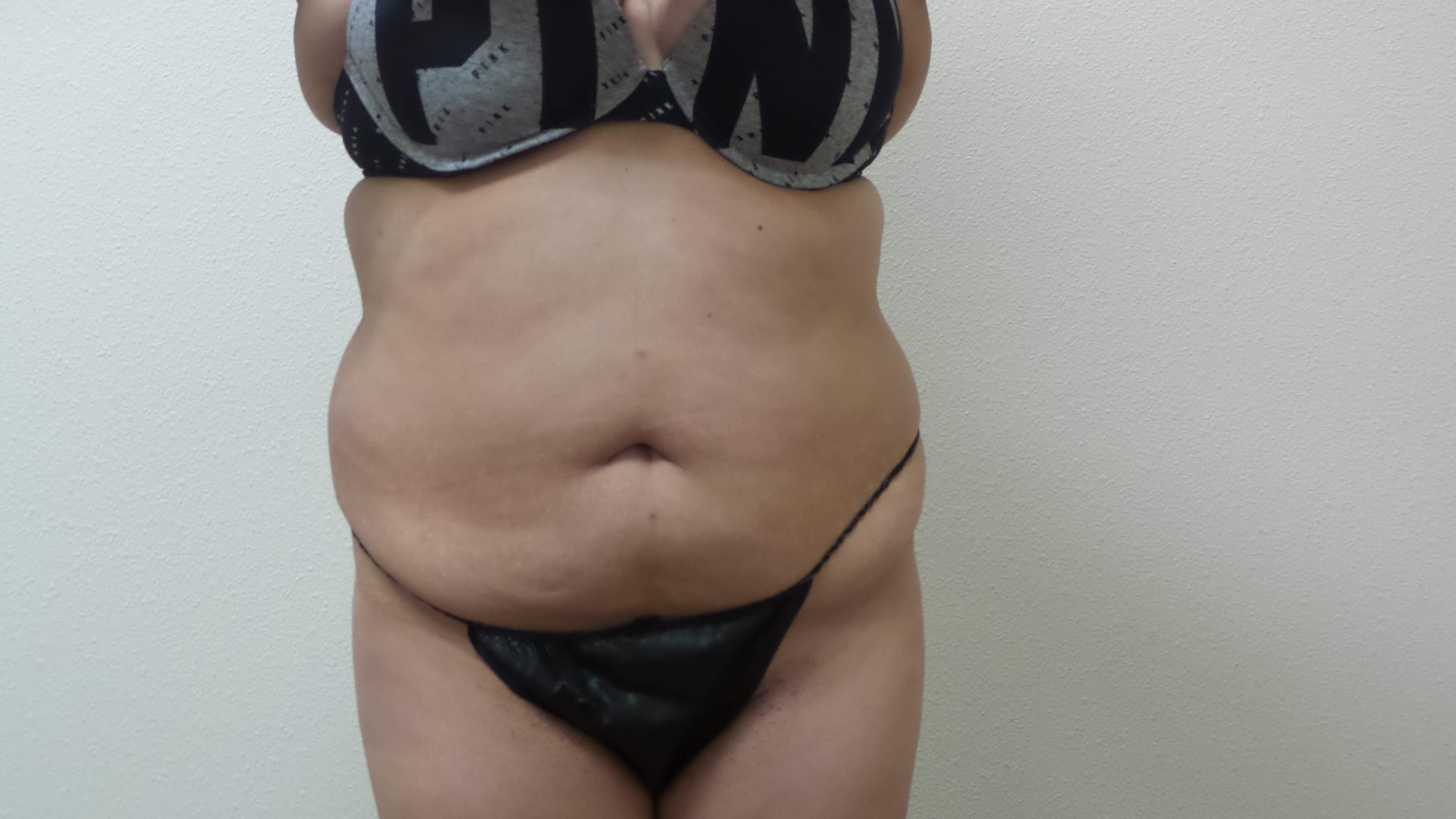 Before Image