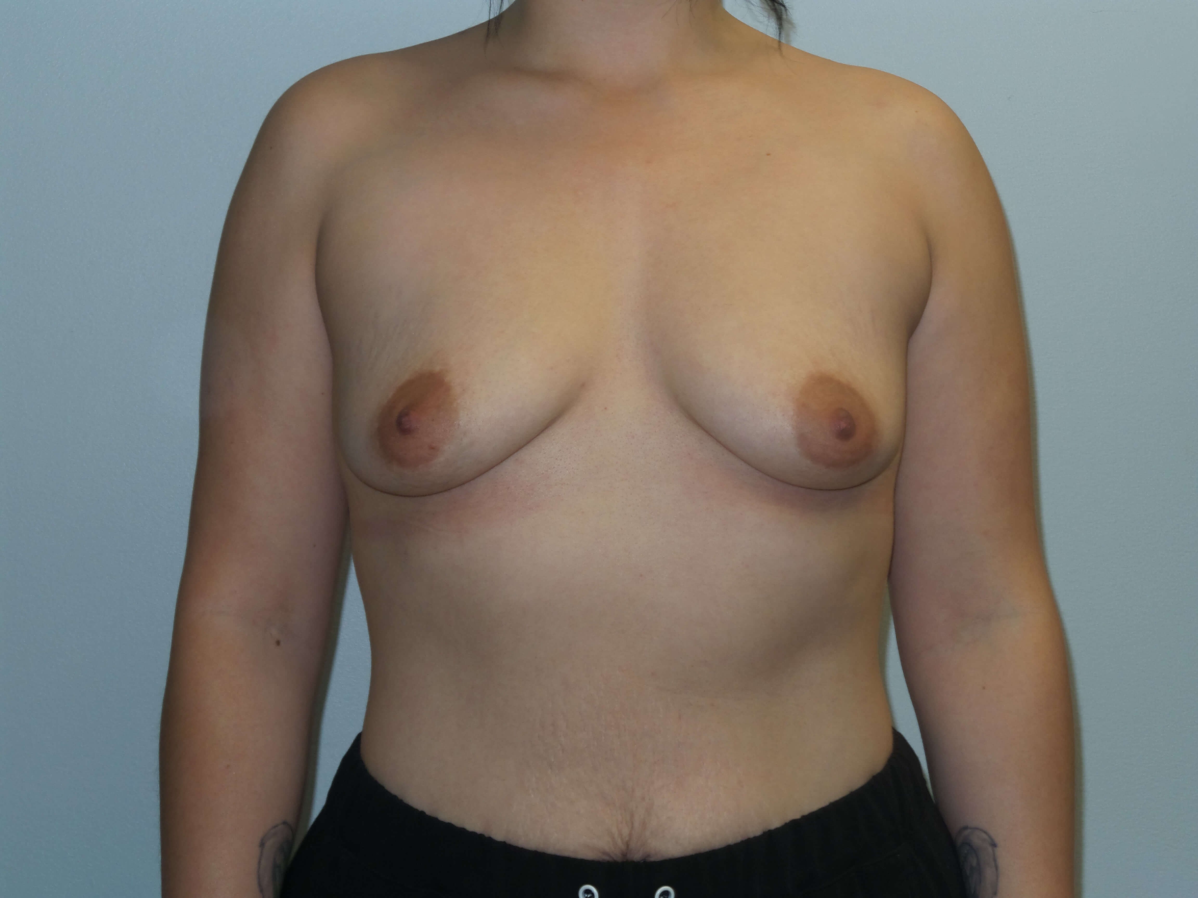 Before Image
