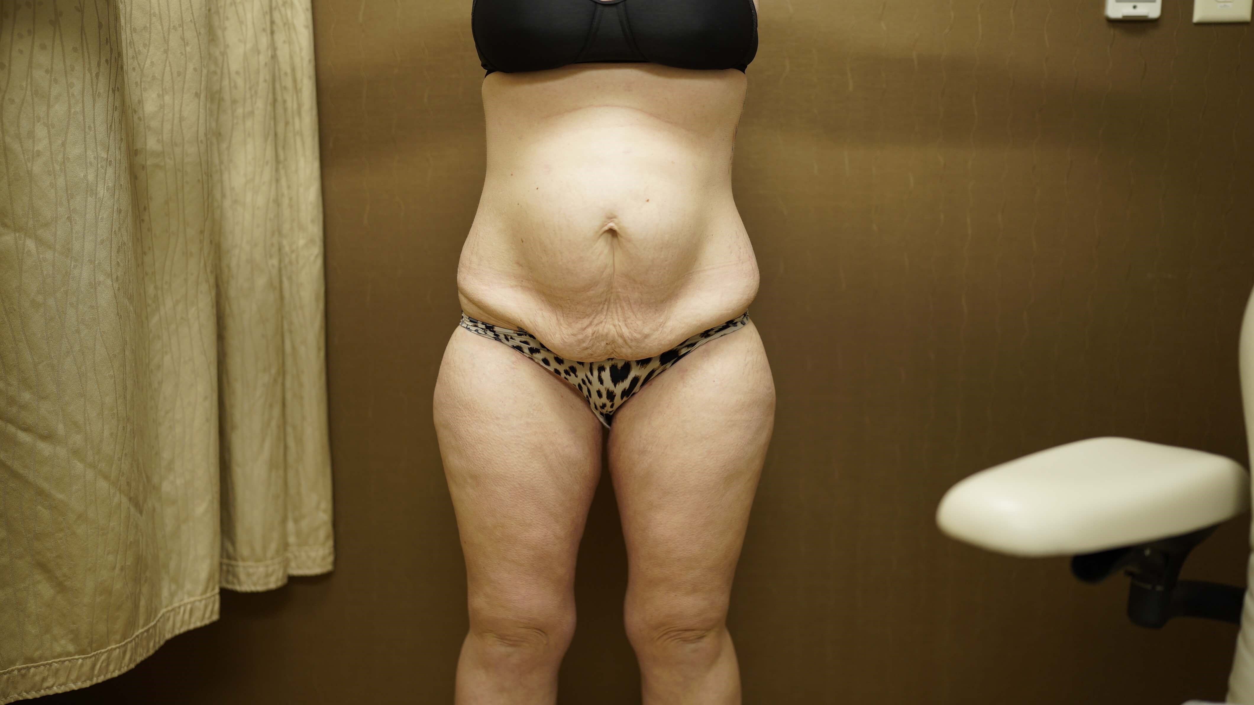 Before Image