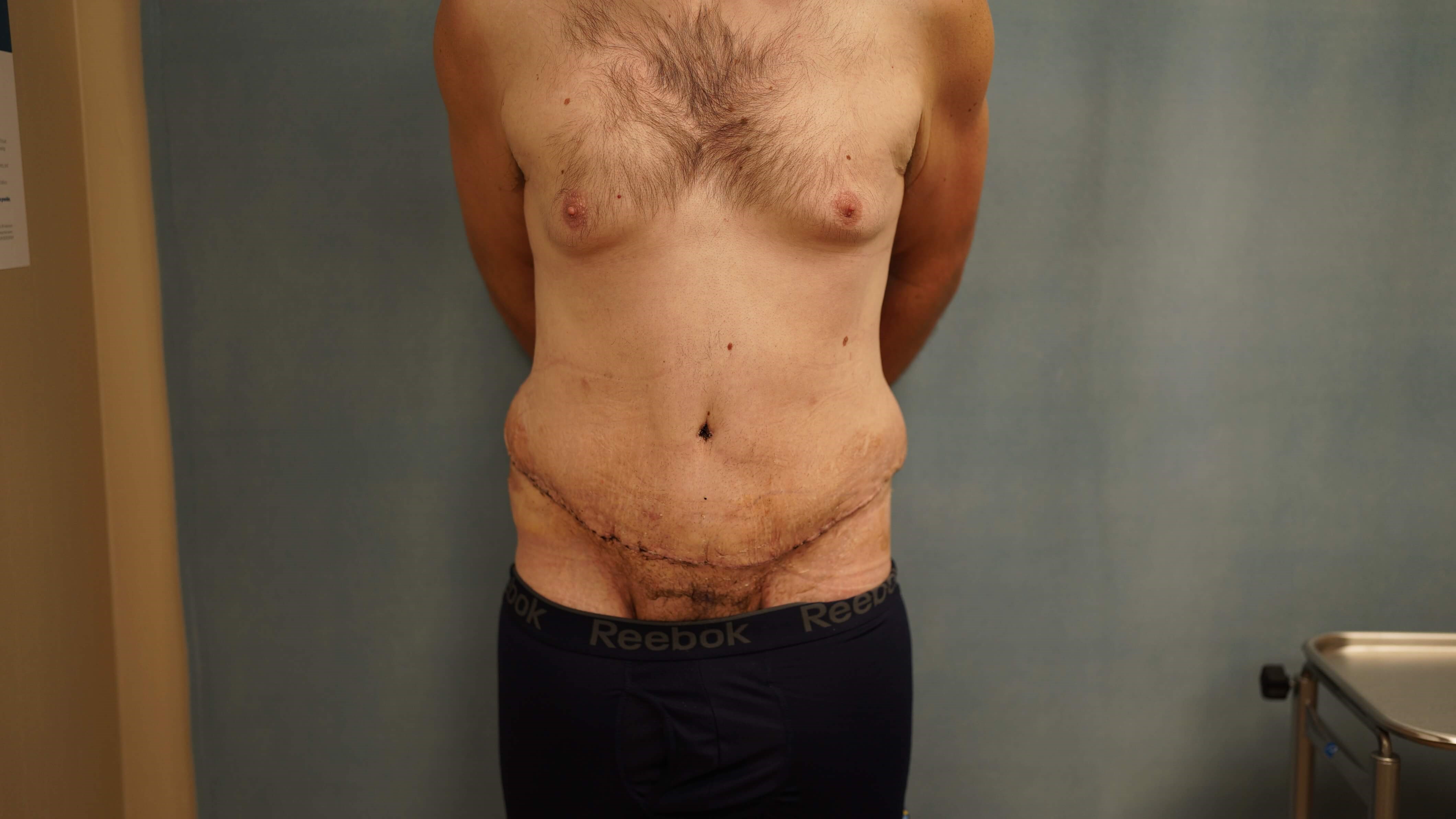 After Image