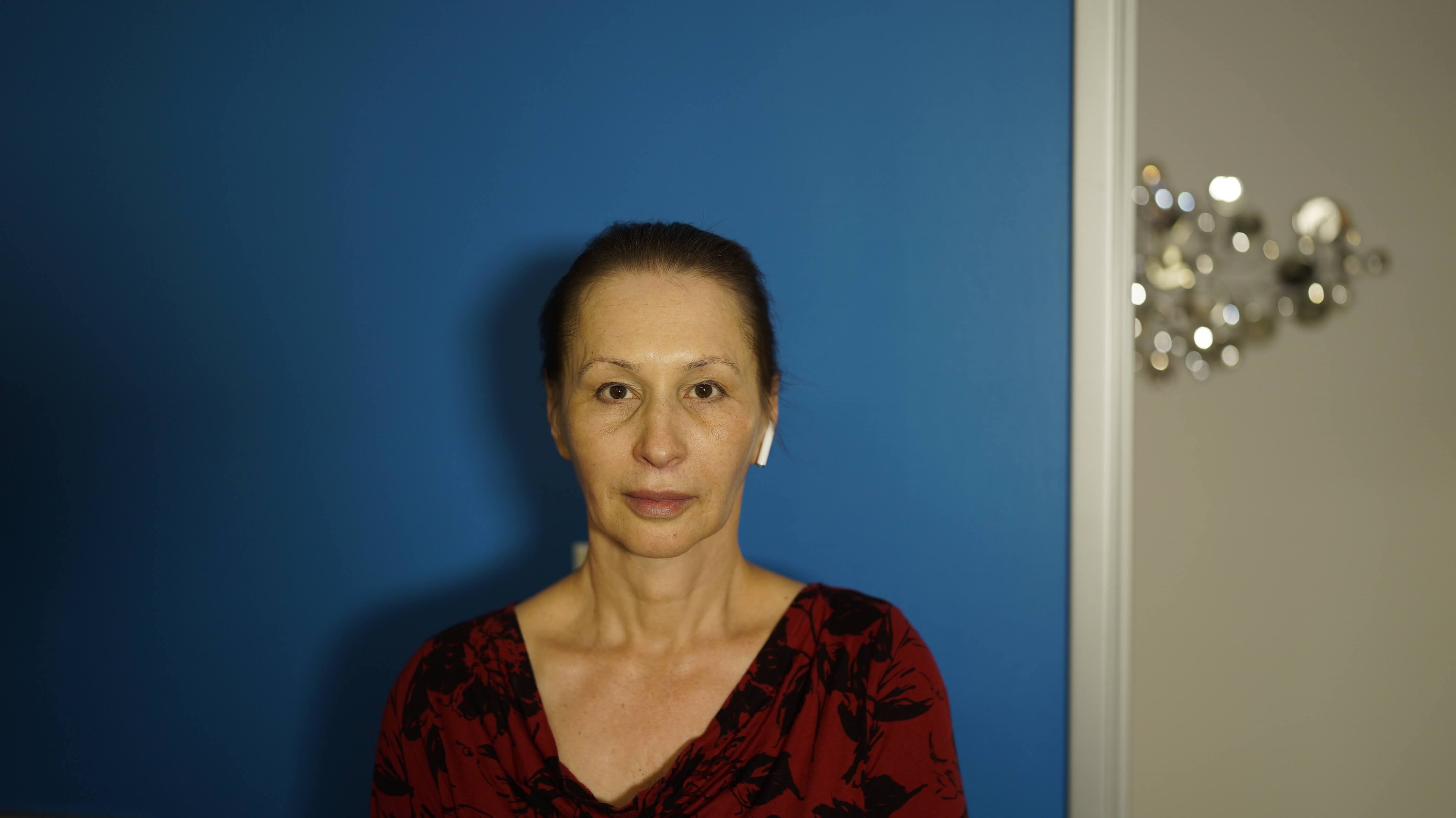 Woman has Neck Lift, Fat Graft After