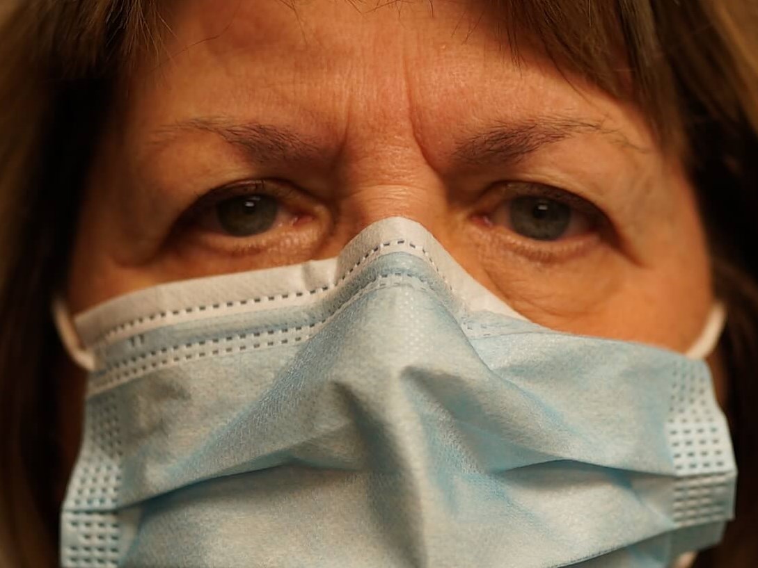 Woman has Upper Eyelid Lift Before