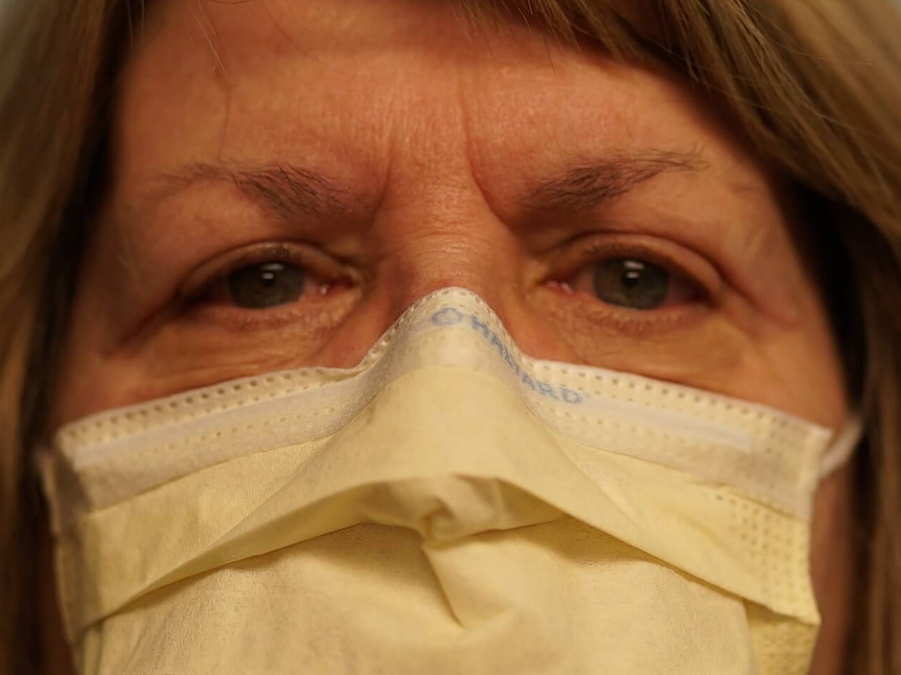 Woman has Upper Eyelid Lift After